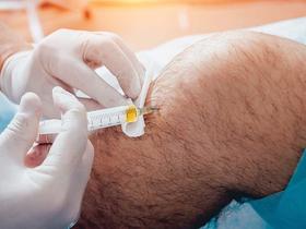PRP injection in knee
